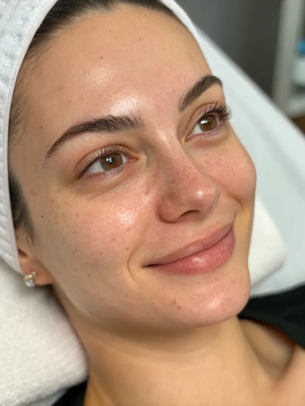 A close-up shot of a woman's radiant, healthy skin after a cosmiatric facial treatment, emphasizing the natural glow and rejuvenated appearance.